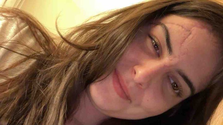 Help My Sister Angaliegh Recover After Accident campaign photo, 1 of 6