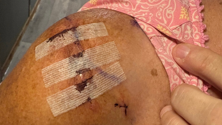 Kimberly Needs Your Help After Accident campaign photo, 1 of 4