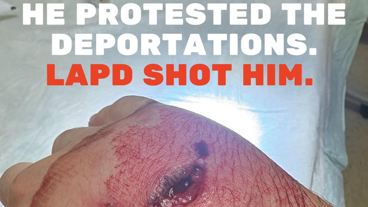 Anti-ICE Protestor Shot by LAPD campaign photo, 1 of 6