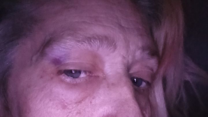 Tumor Causing Seizures: I Need Your Help campaign photo, 1 of 4