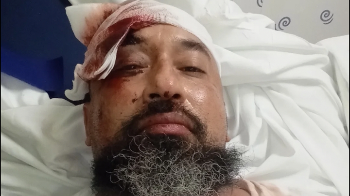 Help Martin Rubio Heal After Tragic Accident campaign photo, 1 of 5