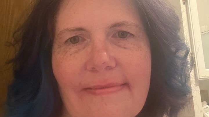 Help Raise Money for My Lupus Journey campaign photo, 1 of 5