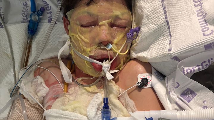Help 14yo Kain Hulett Recover after a Devastating Accident campaign photo, 1 of 4