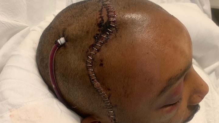 Help LaVon On His Long Road To Recovery campaign photo, 1 of 7