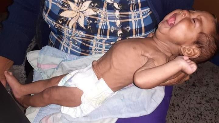 Ayuda a los niños desnutridos de Venezuela campaign photo, 1 of 2