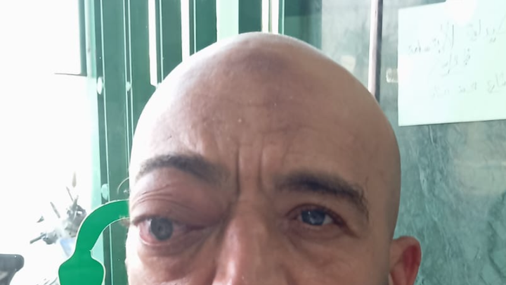 Foto van campagne Help onze broeder met een dringende oogoperatie in Marokko, 1 van 4