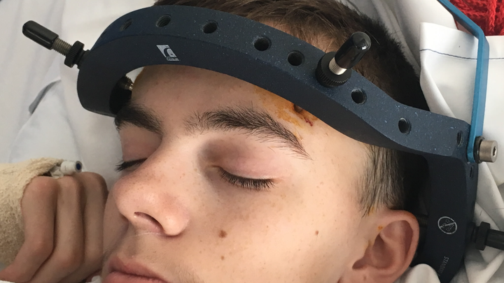 The Final Hurdle - Help Zac breathe, eat & finally heal campaign photo, 1 of 8
