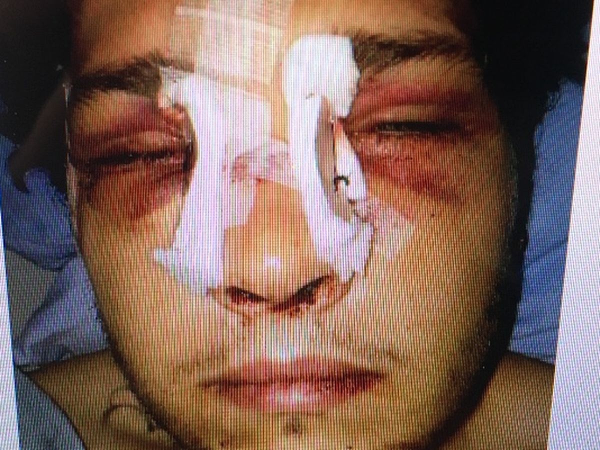 Ryan's Recovery From Hockey Attack campaign photo, 1 of 3