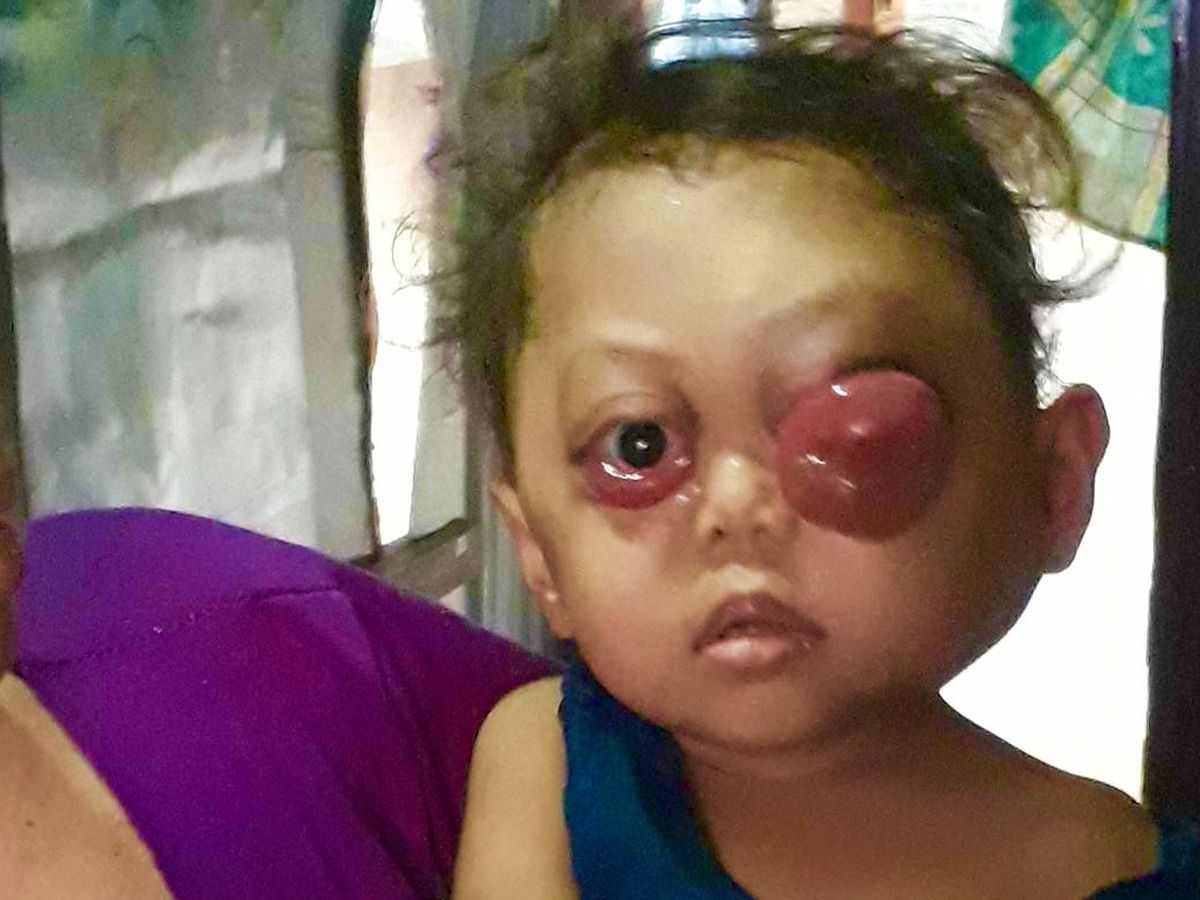 Endris Children's Hospital House - Indonesia campaign photo, 1 of 3