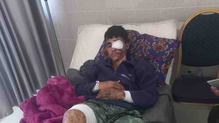 Help Mahmoud survive after devastating loss campaign photo, 1 of 8