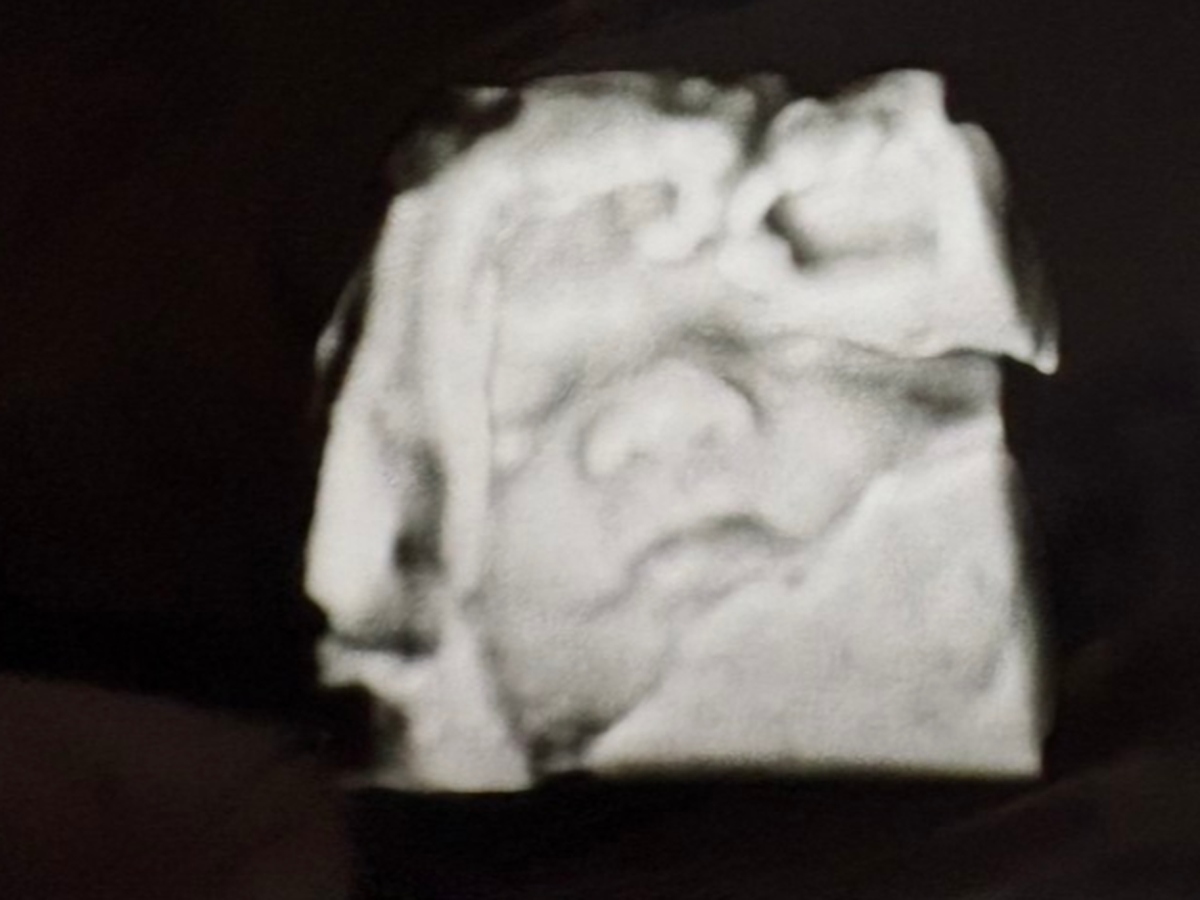 Fundraiser’s main image