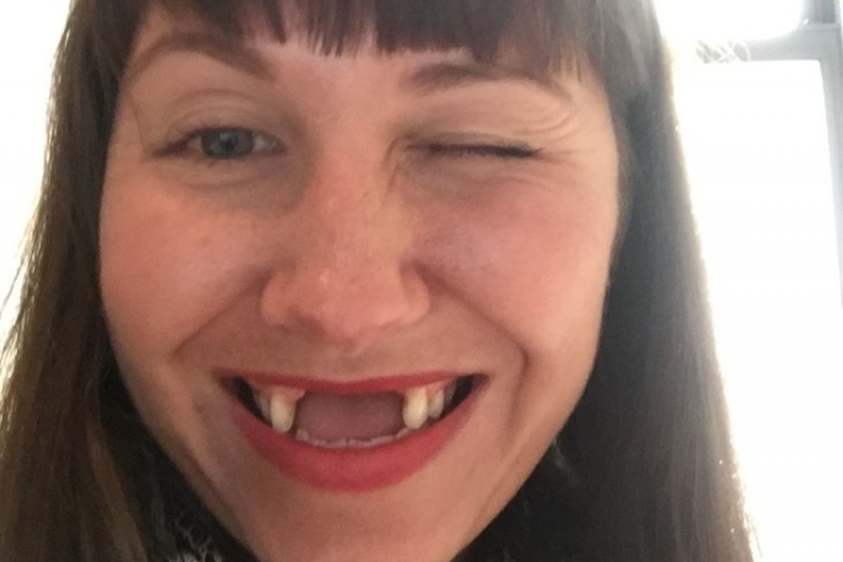 GoFundMe: Gamer begs for help to get £18K implants after losing her teeth  in freak accident
