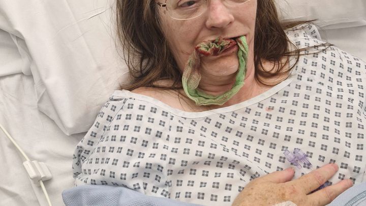 Implants to help me eat campaign photo, 1 of 3