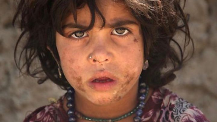 Afghan Father of 9 in Fort Worth Crushed by War Journey Debt campaign photo, 1 of 3