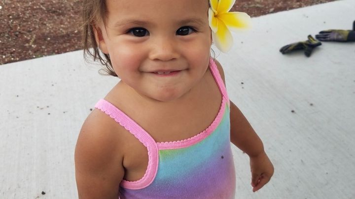Support for Poʻi Girl's Medical Expenses campaign photo, 1 of 2