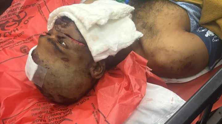 Help a 23-Year-Old Recover After a Devastating Accident, campaign photo, 1 of 5