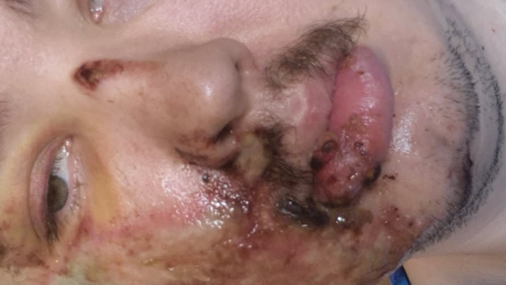 Help Needed: Motorcycle Accident Recovery campaign photo, 1 of 6