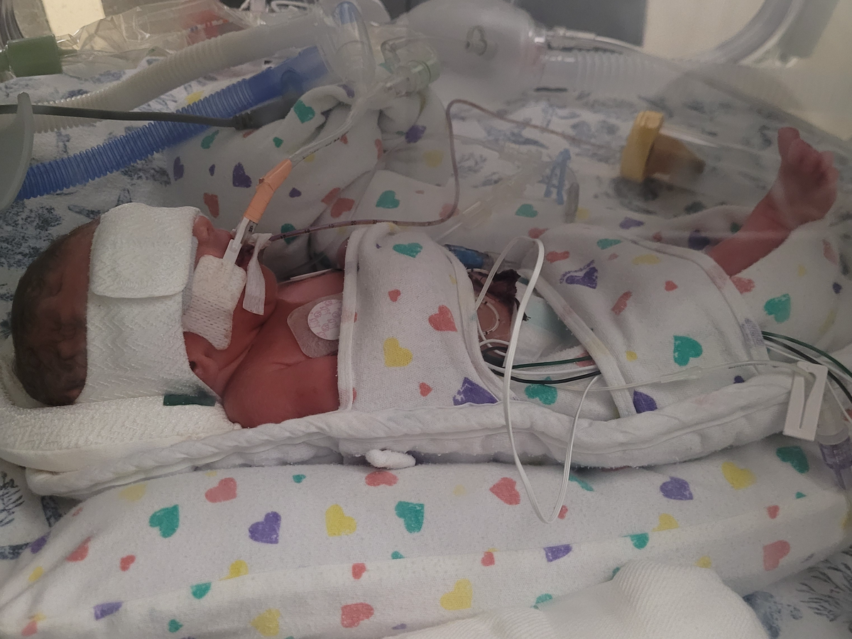 Help For Baby Jaxson campaign photo, 1 of 5