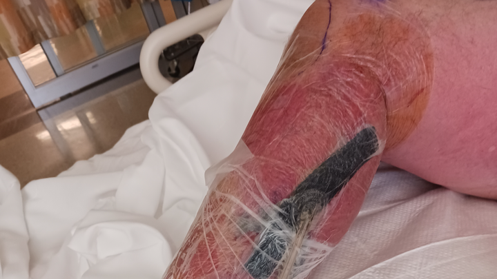 Help Cowboy Recover from Severe Infection campaign photo, 1 of 6