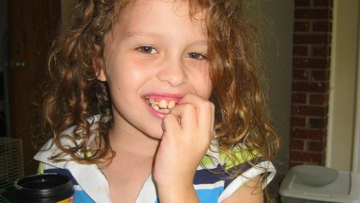 Let's Get Savannah Teeth campaign photo, 1 of 4