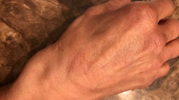 Foto principale della raccolta fondi