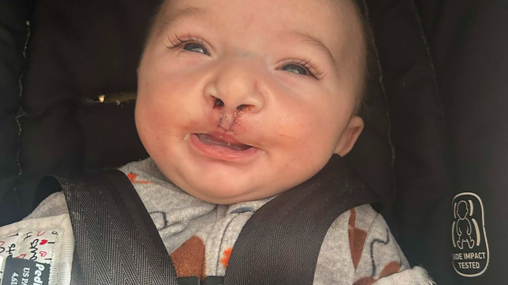 Medical help for Liam and family campaign photo, 1 of 3