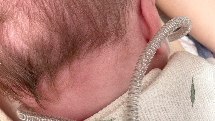 Rennen voor Strong Babies! campaign photo, 1 of 6