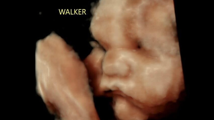 Walker’s Journey: A Heart to Heal, A Family to Hold campaign photo, 1 of 4