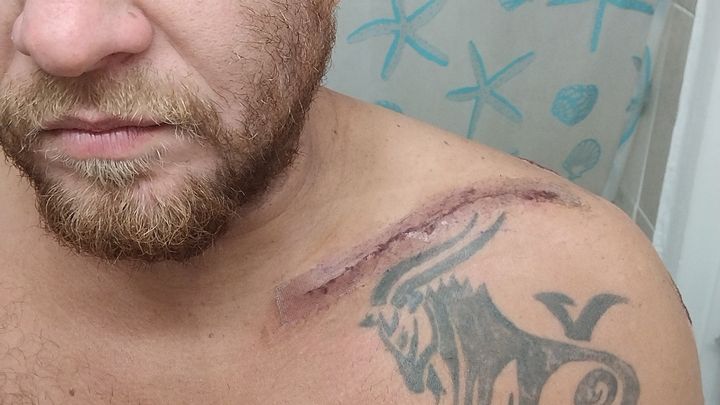 Ebike accident changed my life campaign photo, 1 of 7