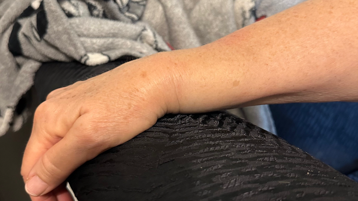 Rally for Mom's Wrist Surgery Costs campaign photo, 1 of 6