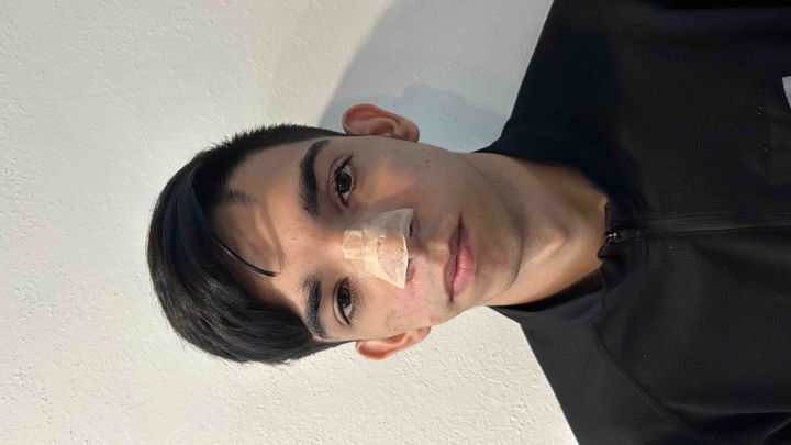 Fundraiser by Tony Ruesga : Help Jose Ángel have his maxilofacial surgery