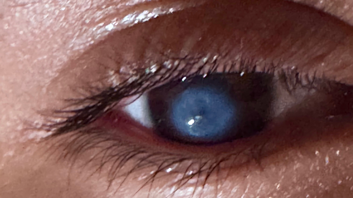 Family Plea: Restore Kevin's Eyesight campaign photo, 1 of 5