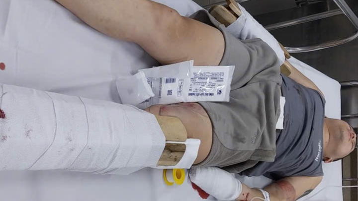 Brother injured in scooter accident campaign photo, 1 of 6