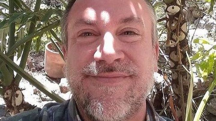 Help Jef Johnson get emergency dental surgery campaign photo, 1 of 3