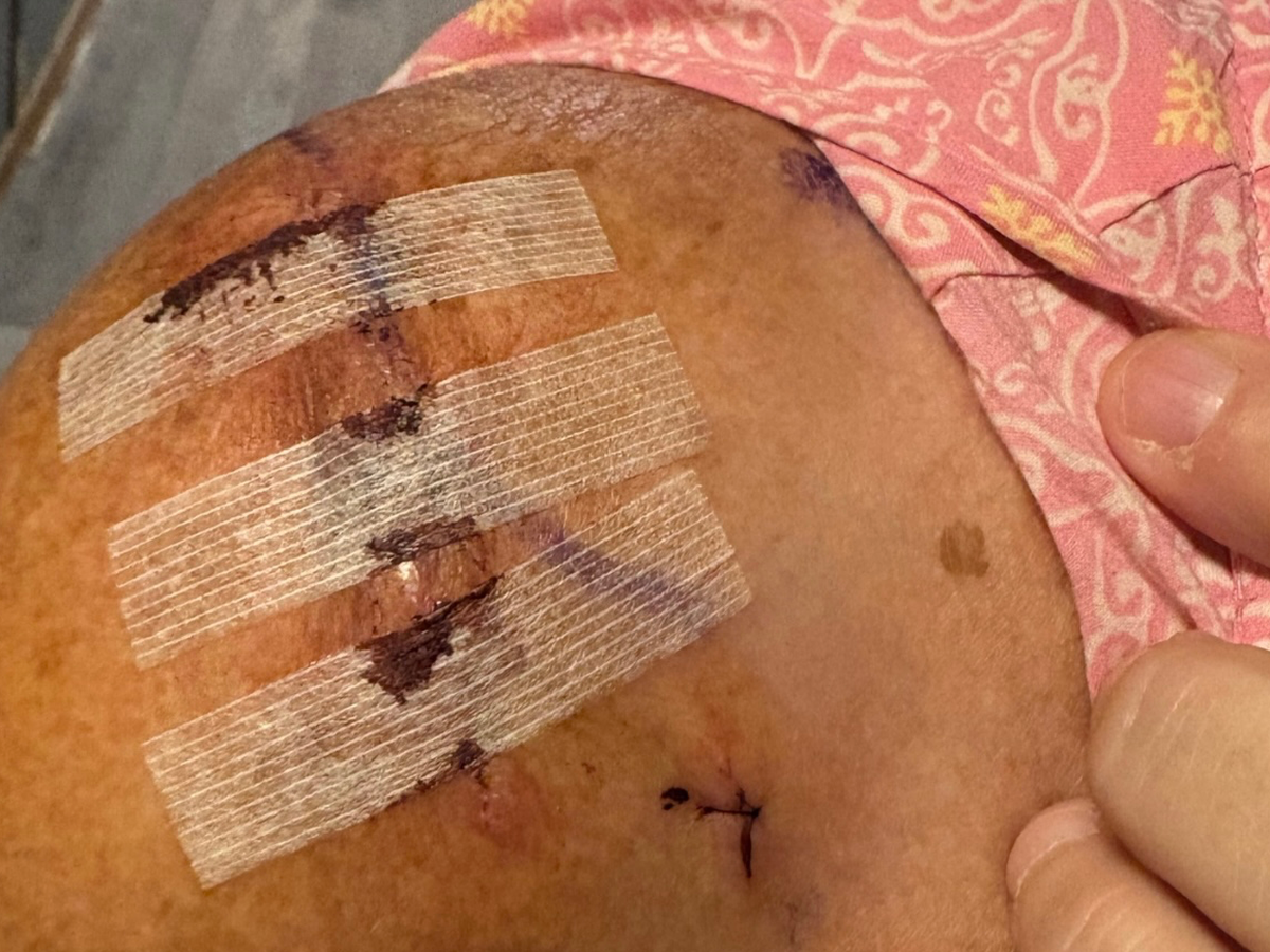 Kimberly Needs Your Help After Accident campaign photo, 1 of 4