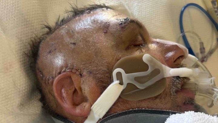 Foto da arrecadação Help Jimmy Pawlowski Fight for His Life, 1 de 12