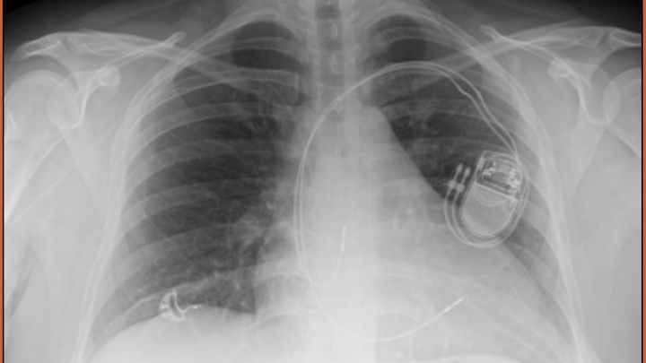 Support Stephanie's Heart Surgery Recovery campaign photo, 1 of 7