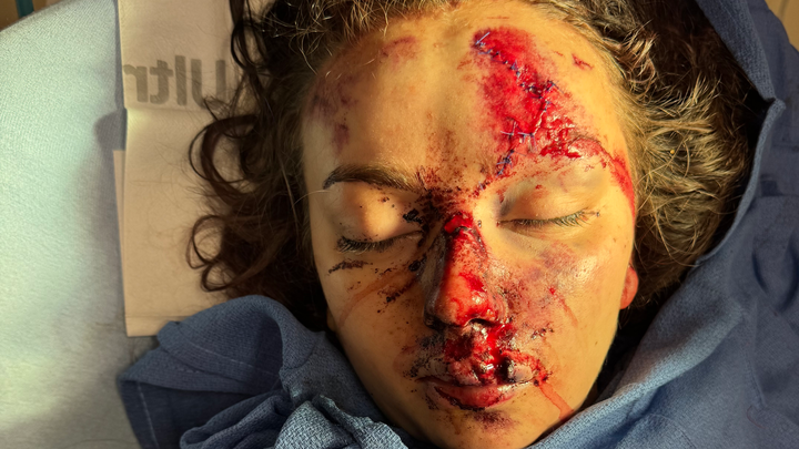 Fundraiser by Hailey Burch : Help Hailey Burch Heal After Car Accident