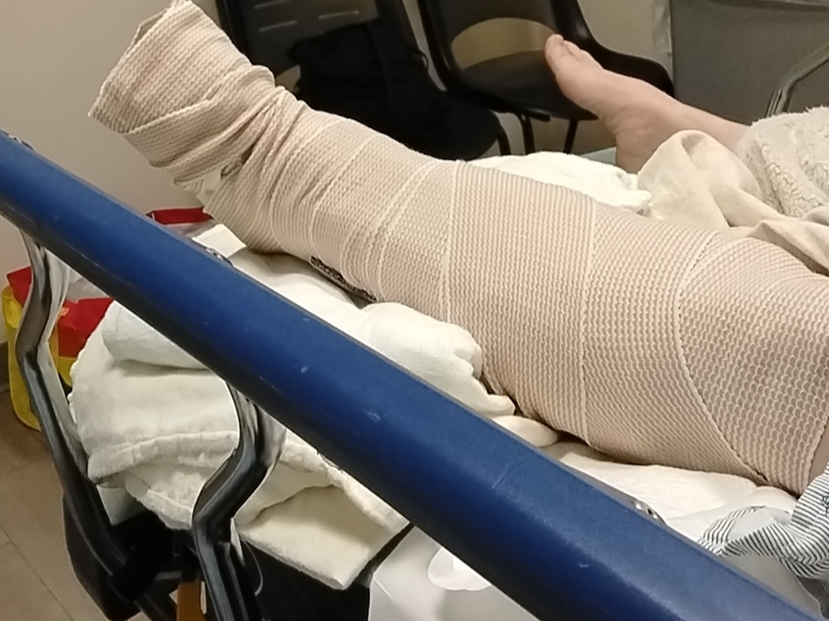 Fundraiser by Phyllis Huffman : Support Robin Young After Her Ankle Surgery