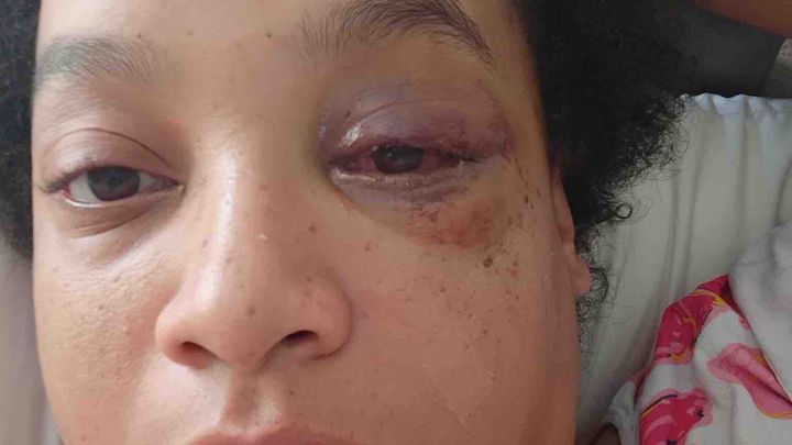 Support Kiesha and Her Son’s Recovery campaign photo, 1 of 4