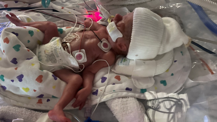 Foto van campagne Support Baby Weston, Chelsea & Nick, 1 van 7