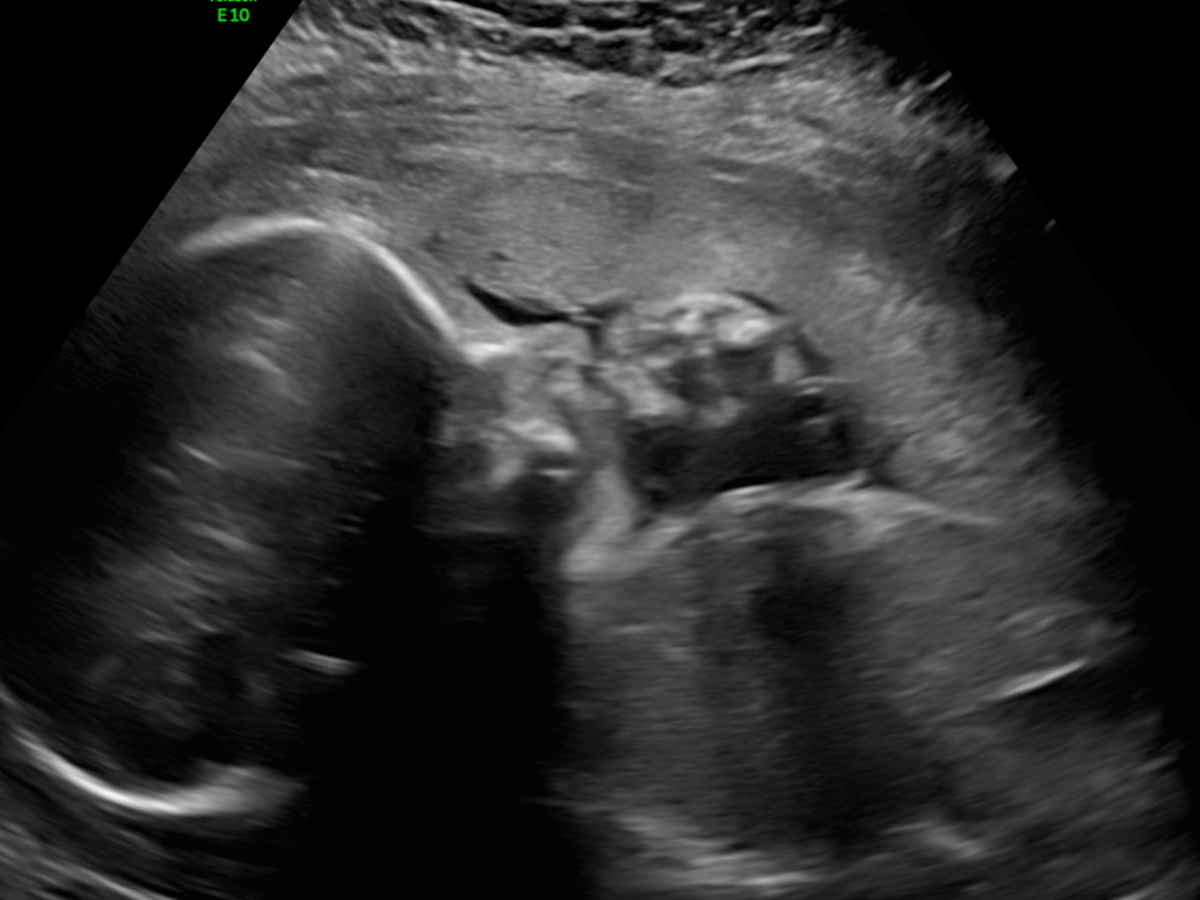 Fundraiser’s main image