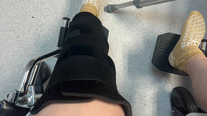 Tibial fracture surgery for Letha Brown campaign photo, 1 of 6