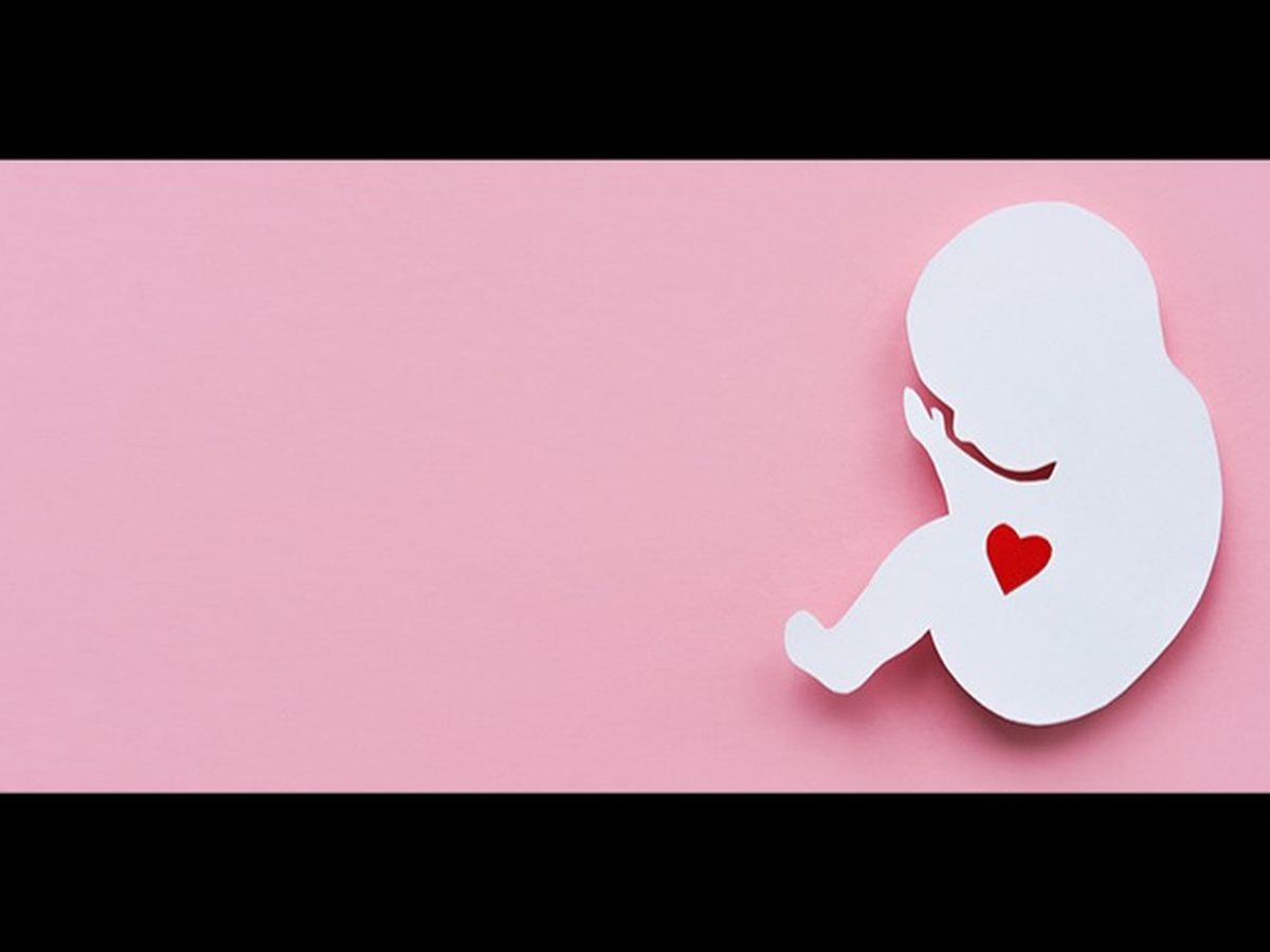 Fundraiser’s main image