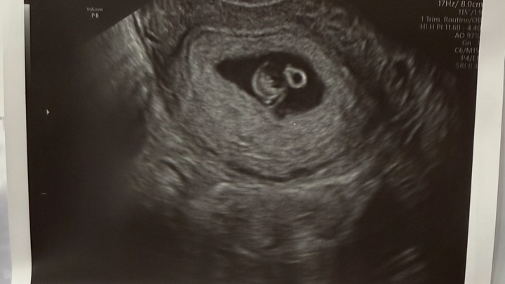 Our sweet baby boy campaign photo, 1 of 3