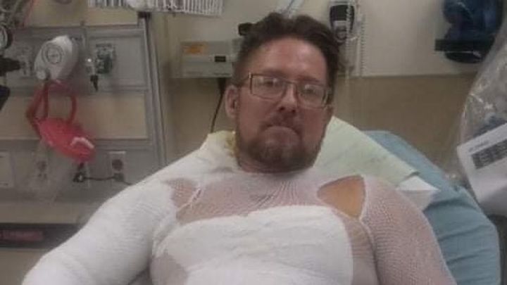 Help Billy Maxx heal campaign photo, 1 of 2