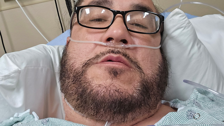 Support Mike's Open-Heart Surgery Recovery campaign photo, 1 of 3