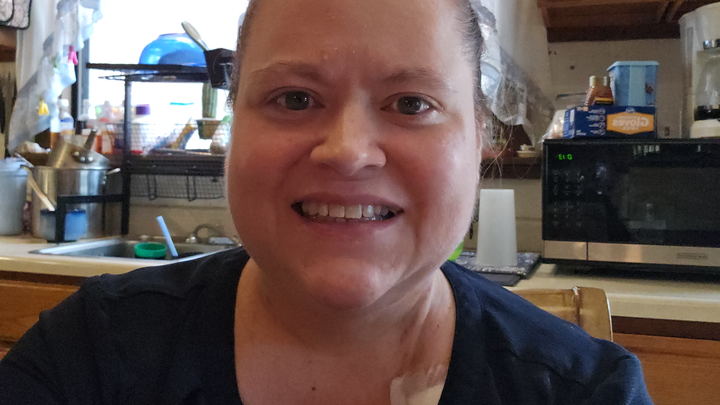 Donate to Aid Recovery from Multiple Transplants campaign photo, 1 of 3