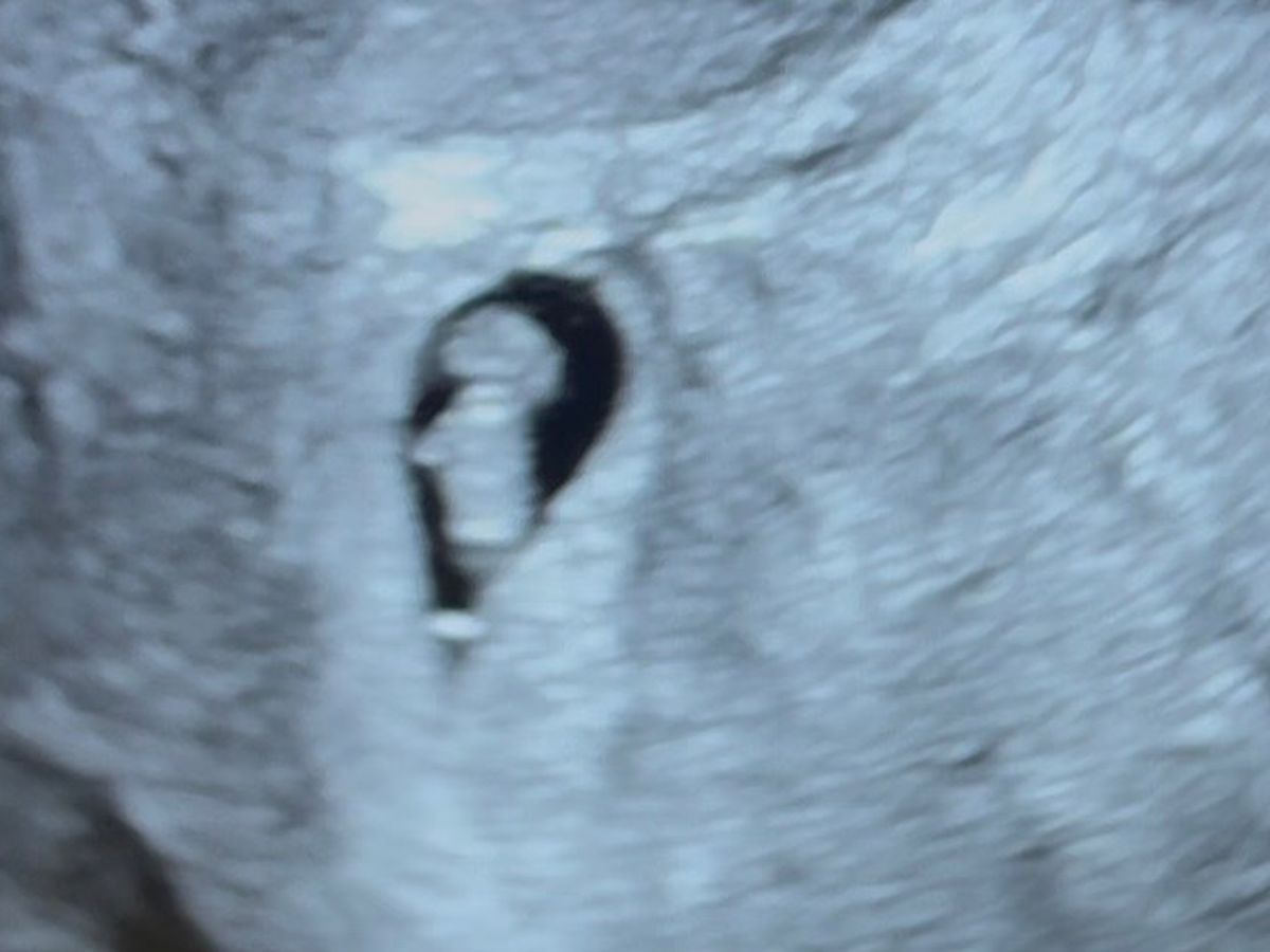 Fundraiser’s main image
