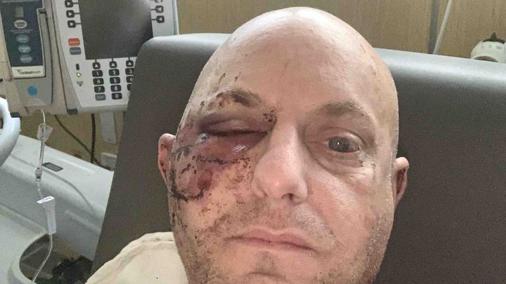High Speed Hit And Run Leaves Josh Needing Help campaign photo, 1 of 2
